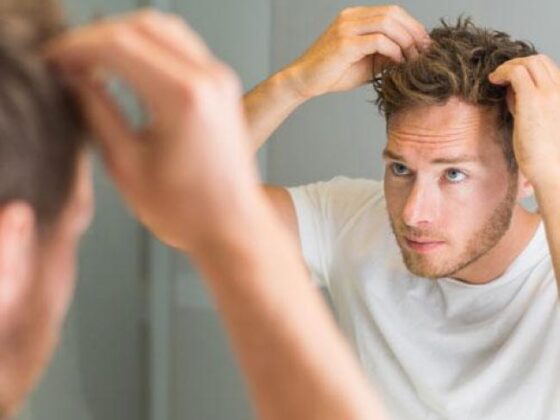 Caduta dei capelli ecco il rimedio