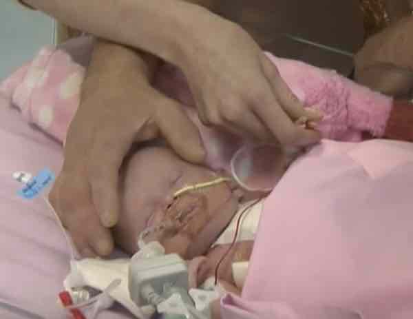 Bambina nata con il cuore fuori dal corpo, ora sta bene