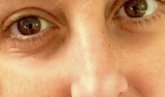 Nadia Toffa e la foto che ci fa preoccupare per la sua salute