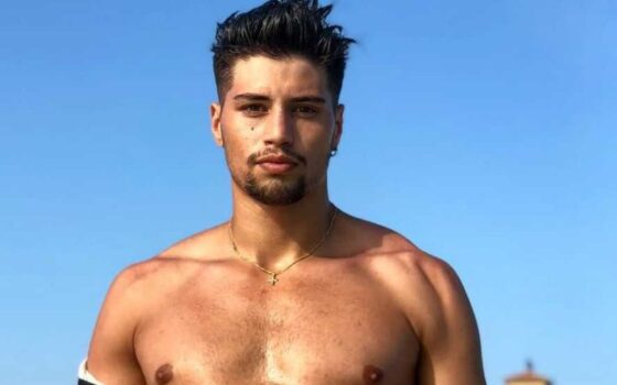 Niccolò Bettarini al mare mostra i segni delle coltellate ricevute [FOTO]