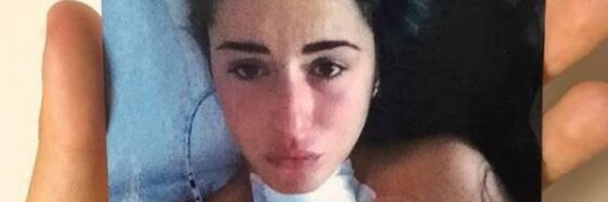 VALENTINA VIGNALI CANCRO TIROIDE