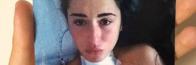 VALENTINA VIGNALI CANCRO TIROIDE