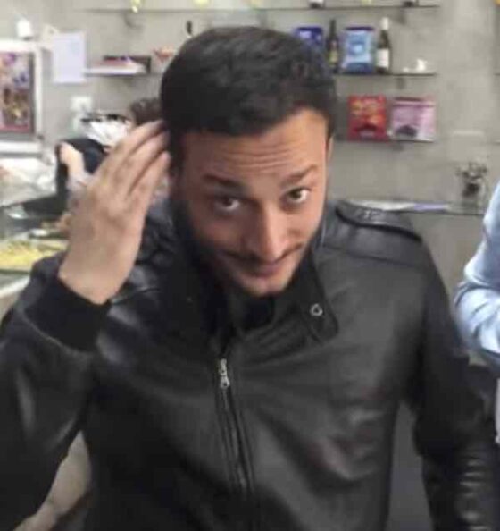 Trapianto di capelli e di barba in Turchia quanto costa? Ecco tutto quello che c'è da sapere